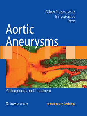 cover image of Aortic Aneurysms